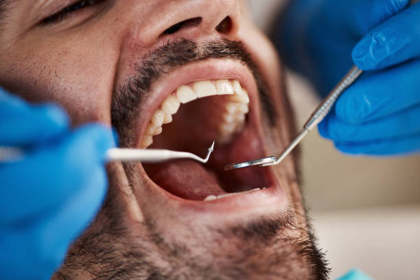 Professional Emergency Dentist in TX